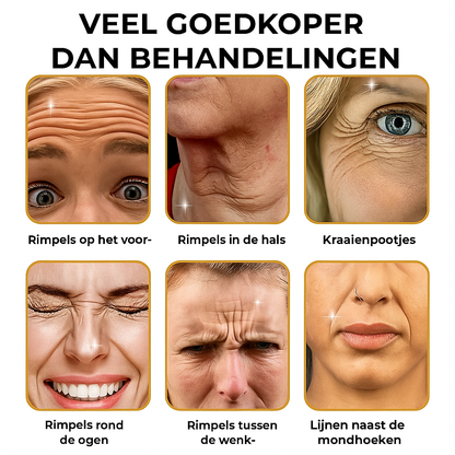 Natuurlijke Rimpelcrème