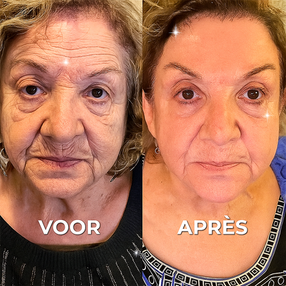 Natuurlijke Rimpelcrème